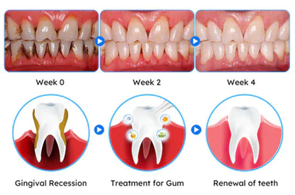 Oveallgo® Gum Care Gel – Restore & Strengthen Your Gums