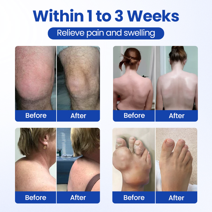 Oveallgo® BPC-157 Joint&Bone Repair Roll-On Gel