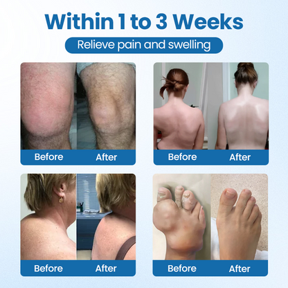 Oveallgo® BPC-157 Joint Repair Cream