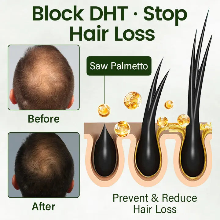 Oveallgo® Follicure BioGrow Hair Regrowth & Follicle Activating Spray