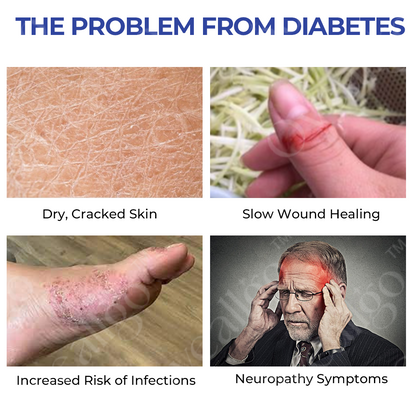 ✅Official Store: Oveallgo™ DiaRelief Ultra Moisture Cream (Specialized for Diabetics)