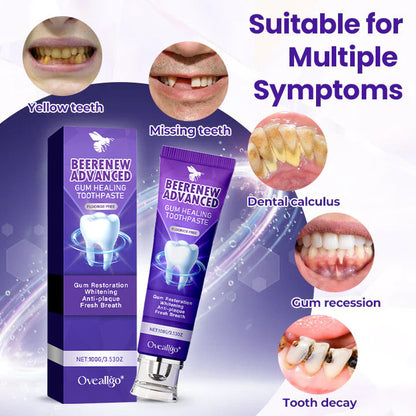 Oveallgo® BeeRenew Advanced Gum Healing Toothpaste