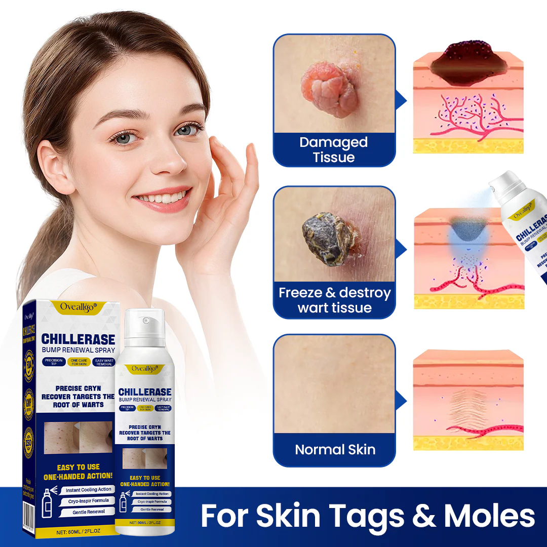 Oveallgo® ChillErase Bump Renewal Spray