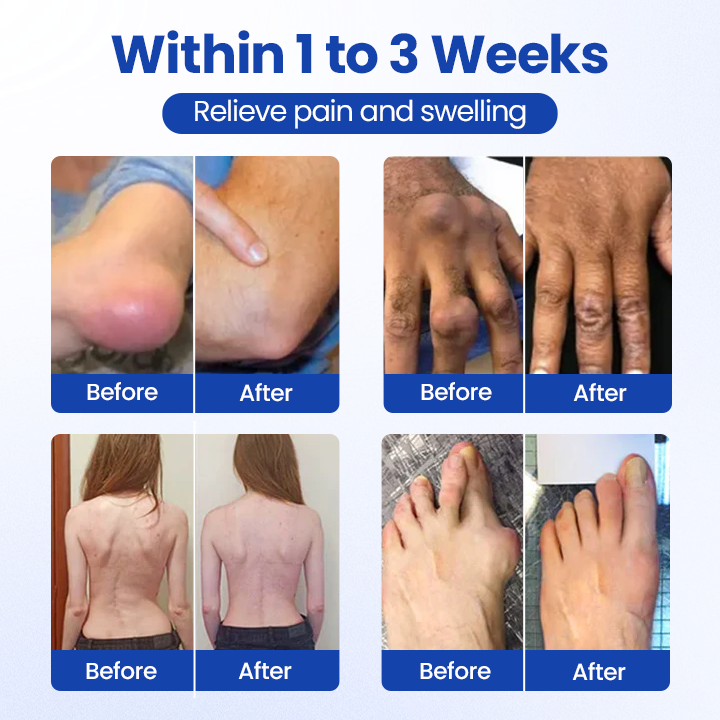 Oveallgo® BPC-157 Joint&Bone Repair Roll-On Gel