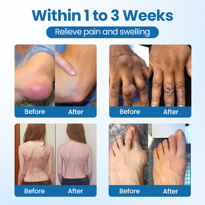 Oveallgo® BPC-157 Joint Repair Cream