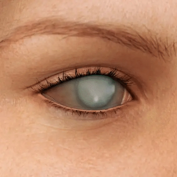 Oveallgo® Nano Eye Drop Serum