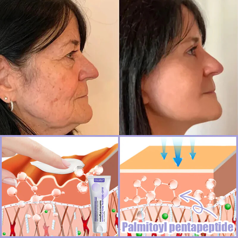 Oveallgo® Anti-Wrinkle Cream To Eliminate Wrinkles, Firm And Whiten The Skin - Last offer! 🔥90% discount