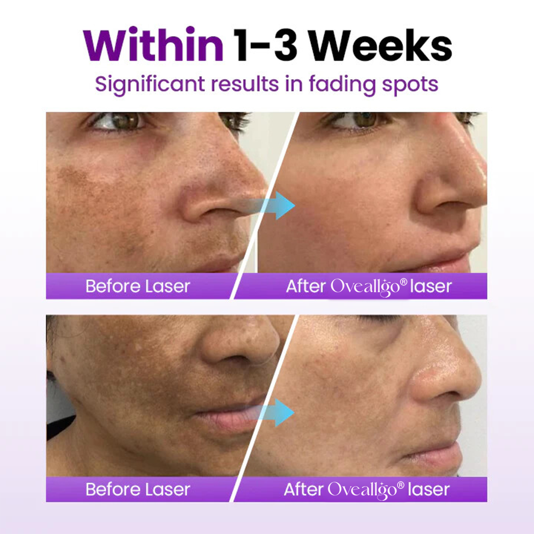 Oveallgo® SpotErase Probiotic Shield Serum