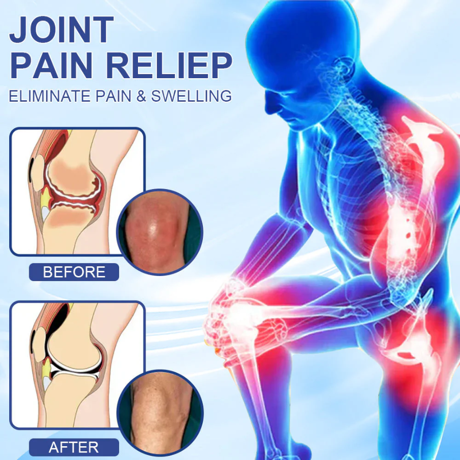 Oveallgo® Advanced Magnesium Pain Relief Cream