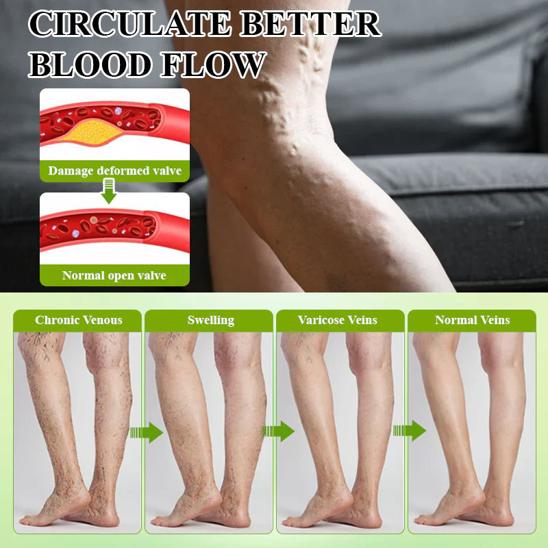 Oveallgo® CircuPro MAX Edema & Lymphatic Support Inhaler