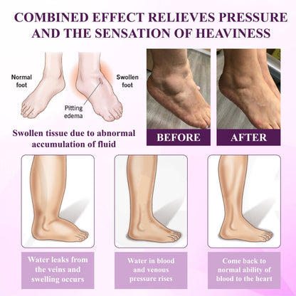 Oveallgo® NightDrain Leg Therapy Edema Cream