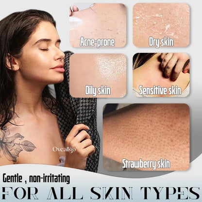 Oveallgo® Luxe-Skin Deep Exfoliating Towel