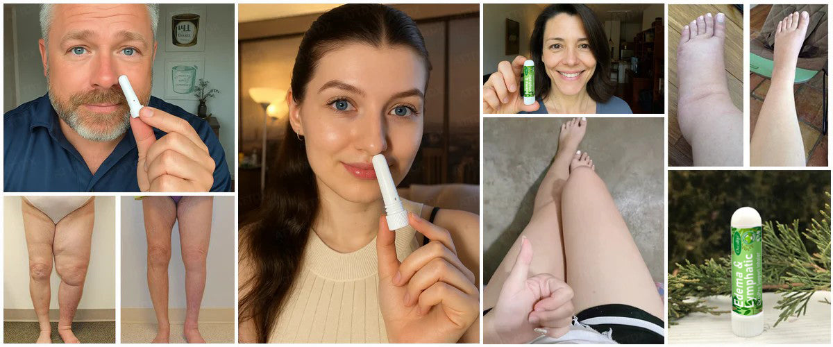 Oveallgo® CircuPro MAX Edema & Lymphatic Support Inhaler