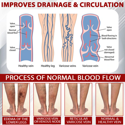 Oveallgo® Advanced CVI Edema Therapy Cream