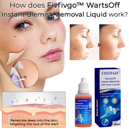 Fivfivgo™ WartsOff Instant Blemish Removal Liquid
