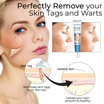 Fivfivgo™ Skin Tags & Warts Remover Cream