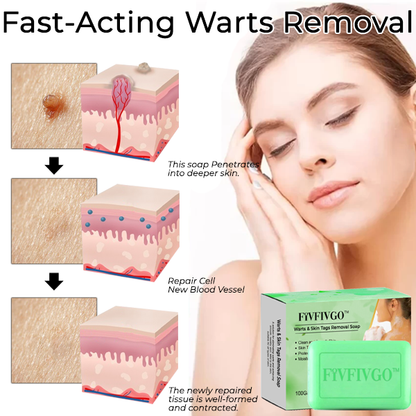 Fivfivgo™ Warts & Skin Tags Removal Soap