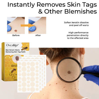 【OFFICIAL STORE】 Oveallgo™ Bee Venom Warts Removing Skin Tag Patch