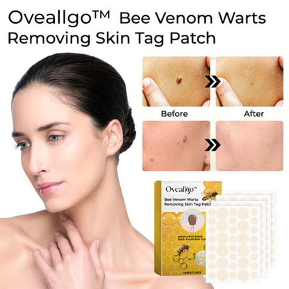 【OFFICIAL STORE】 Oveallgo™ Bee Venom Warts Removing Skin Tag Patch