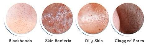 Oveallgo™ Ultrasonic Skin Spatula 12 Oveallgo™ Ultrasonic Skin Spatula