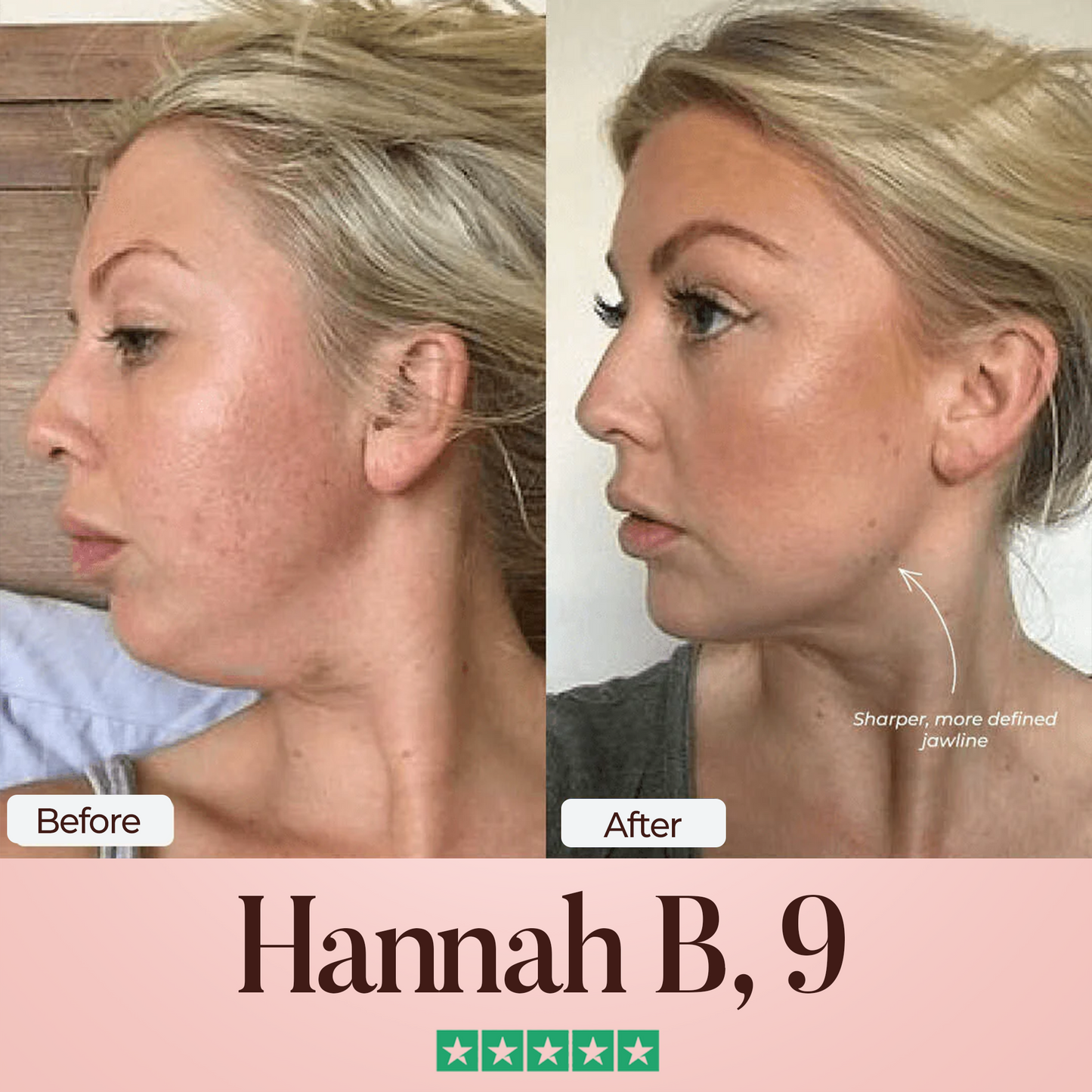 Oveallgo® SculptFix Mask Pro Infused with Retinol & Collagen to Reveal Your Best Jawline