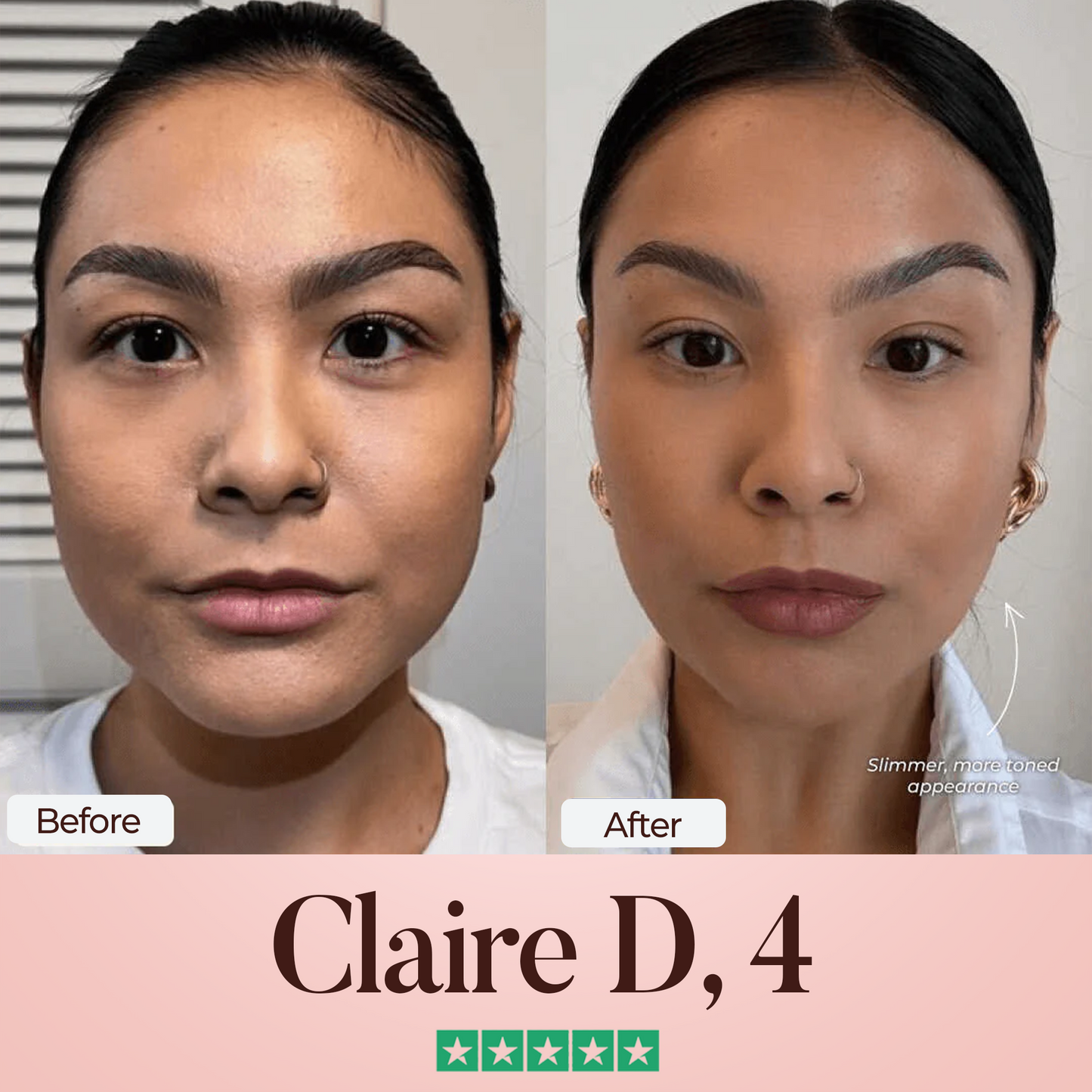 Oveallgo® SculptFix Mask Pro Infused with Retinol & Collagen to Reveal Your Best Jawline