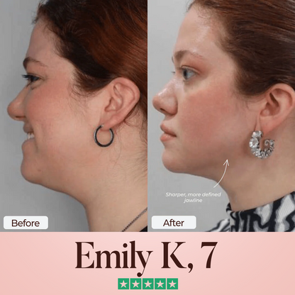 Oveallgo® SculptFix Mask Pro Infused with Retinol & Collagen to Reveal Your Best Jawline