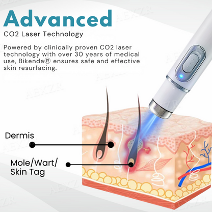 Bikenda® Non-Invasive Mole and Wart Removal Laser Pen