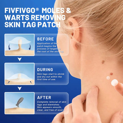 Fivfivgo® Moles & Warts Removing Skin Tag Patch