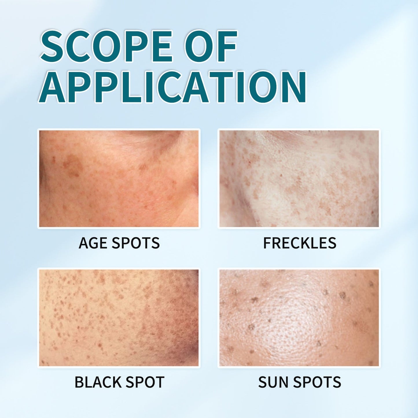 [Official Store] Oveallgo® Blemish Removing Beauty Cream – Fades Dark Spots, Freckles & Wrinkles | Age-Defying, Even-Tone Treatment