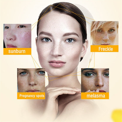 [Official Store] Oveallgo® Blemish Removing Beauty Cream – Fades Dark Spots, Freckles & Wrinkles | Age-Defying, Even-Tone Treatment