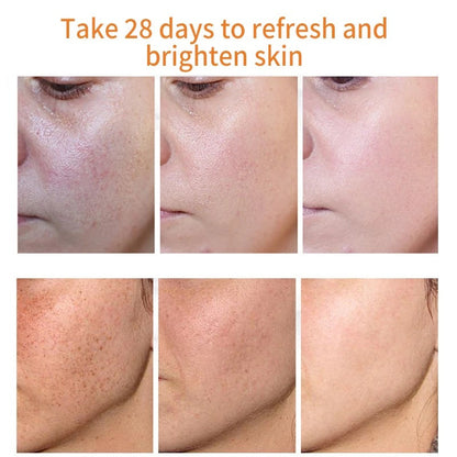 [Official Store] Oveallgo® Blemish Removing Beauty Cream – Fades Dark Spots, Freckles & Wrinkles | Age-Defying, Even-Tone Treatment