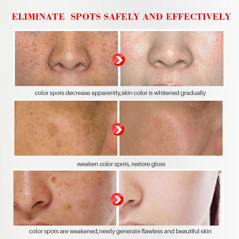 [Official Store] Oveallgo® Blemish Removing Beauty Cream – Fades Dark Spots, Freckles & Wrinkles | Age-Defying, Even-Tone Treatment