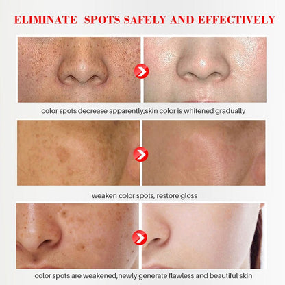 [Official Store] Oveallgo® Blemish Removing Beauty Cream – Fades Dark Spots, Freckles & Wrinkles | Age-Defying, Even-Tone Treatment