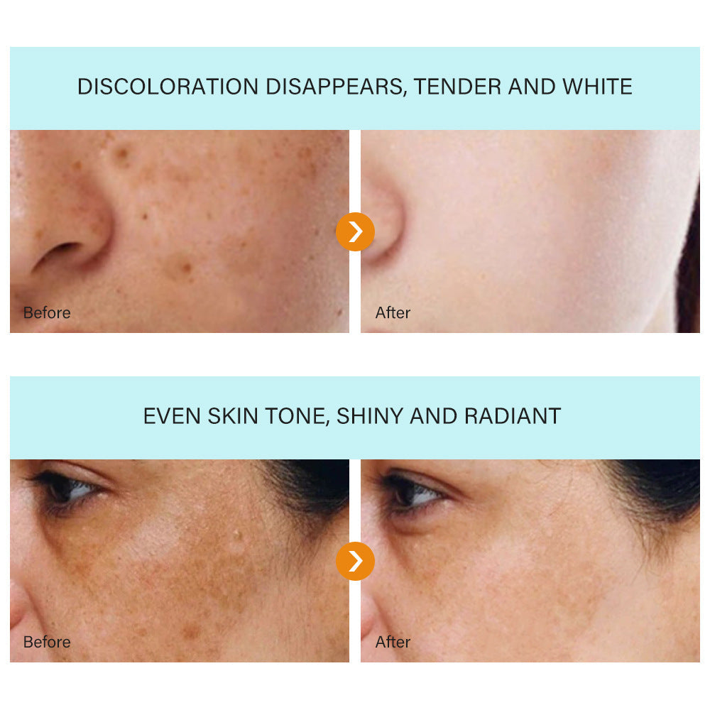 [Official Store] Oveallgo® Blemish Removing Beauty Cream – Fades Dark Spots, Freckles & Wrinkles | Age-Defying, Even-Tone Treatment