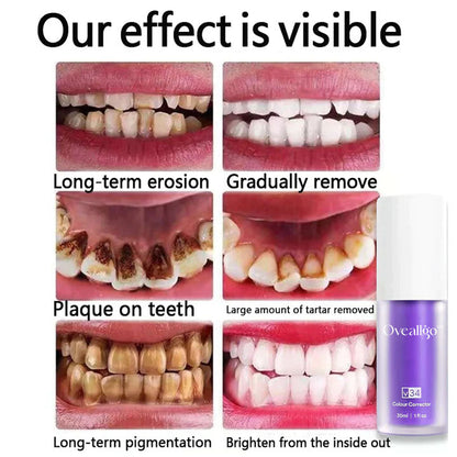 Oveallgo™ Deluxe Herbal Teeth Whitening Mousse