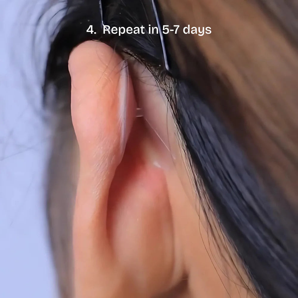 Oveallgo® Ear Correctors 19 Place corrector on the back of your ear 3