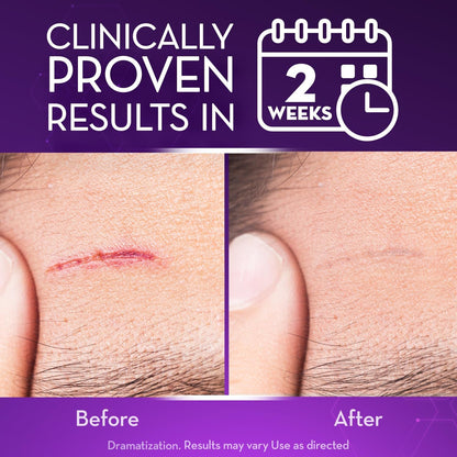 Oveallgo® Advanced Scar Gel Improve The Appearance Of Scars And Stretch Marks