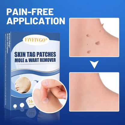 Fivfivgo® Moles & Warts Removing Skin Tag Patch